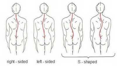 Shape of the spine